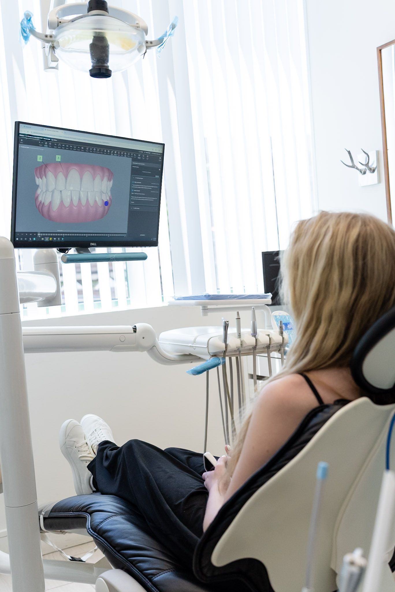 Patient viewing a digital Invisalign smile simulation on the treatment room screen