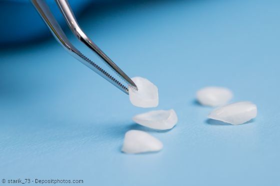 Veneers - hauchzarte aber sehr stabile Verblendschalen können kleine Schönheitsfehler korrigieren