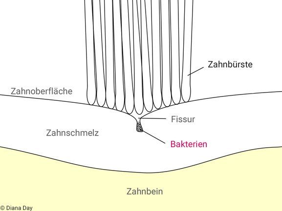Schematische Darstellung der Fissuren