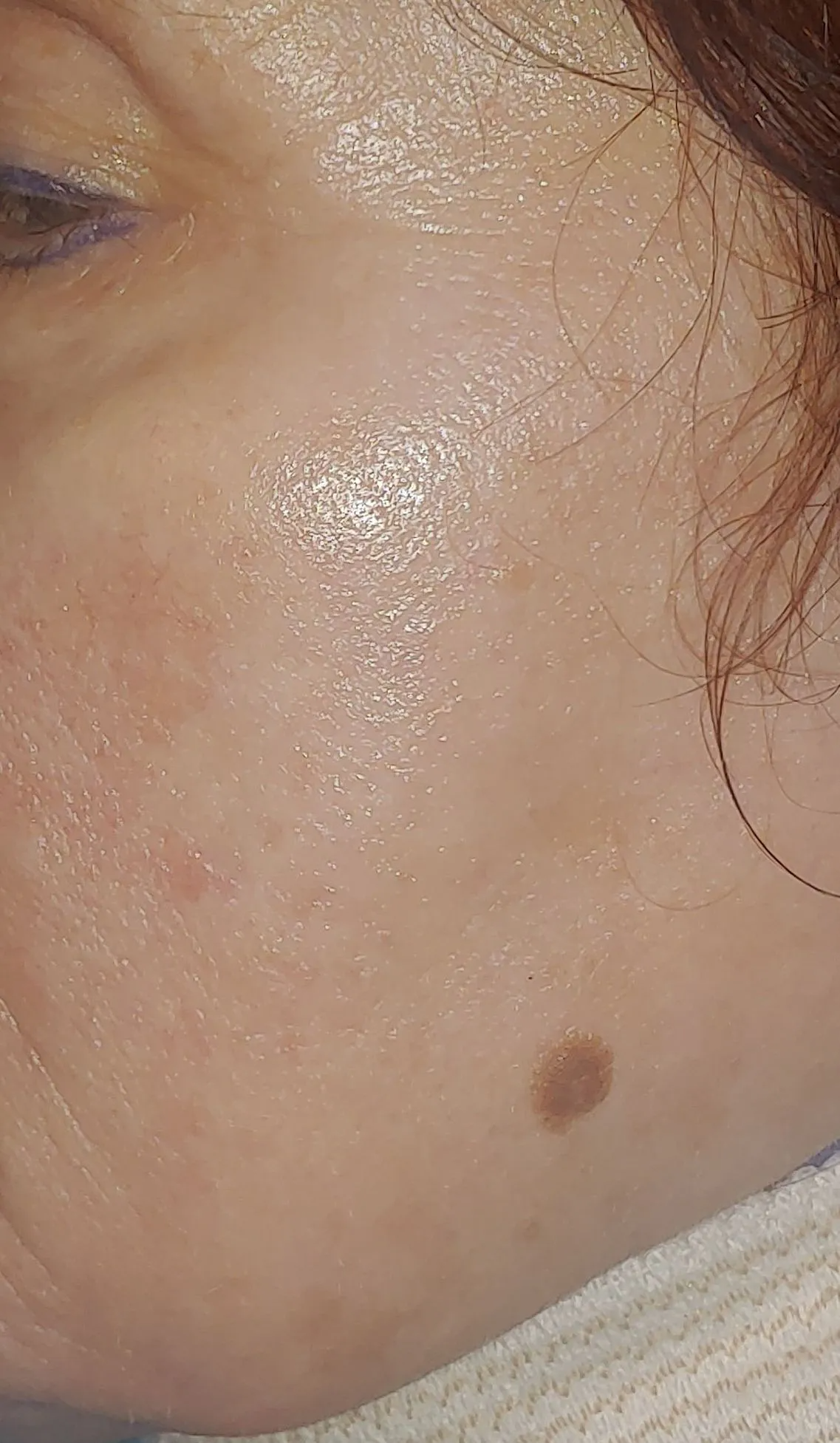 After Natural Skin Care