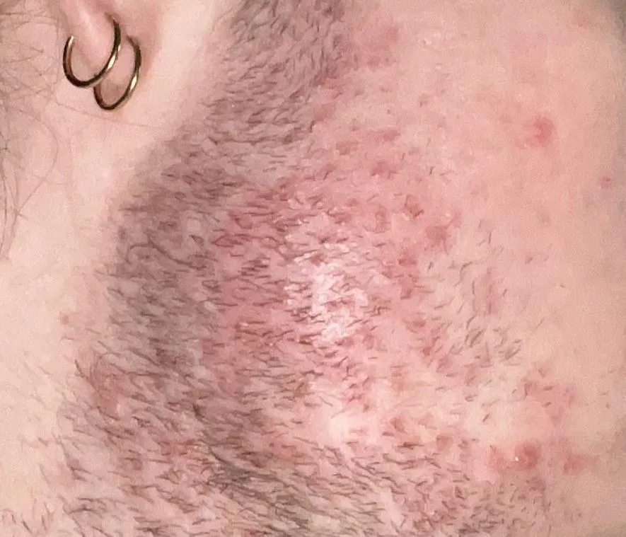 Before Skin Repair
