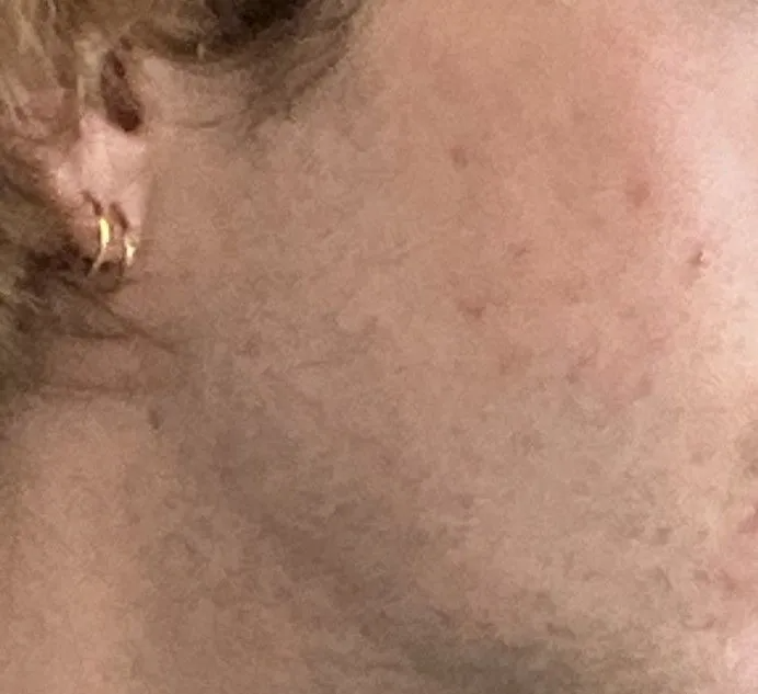 After Skin Repair