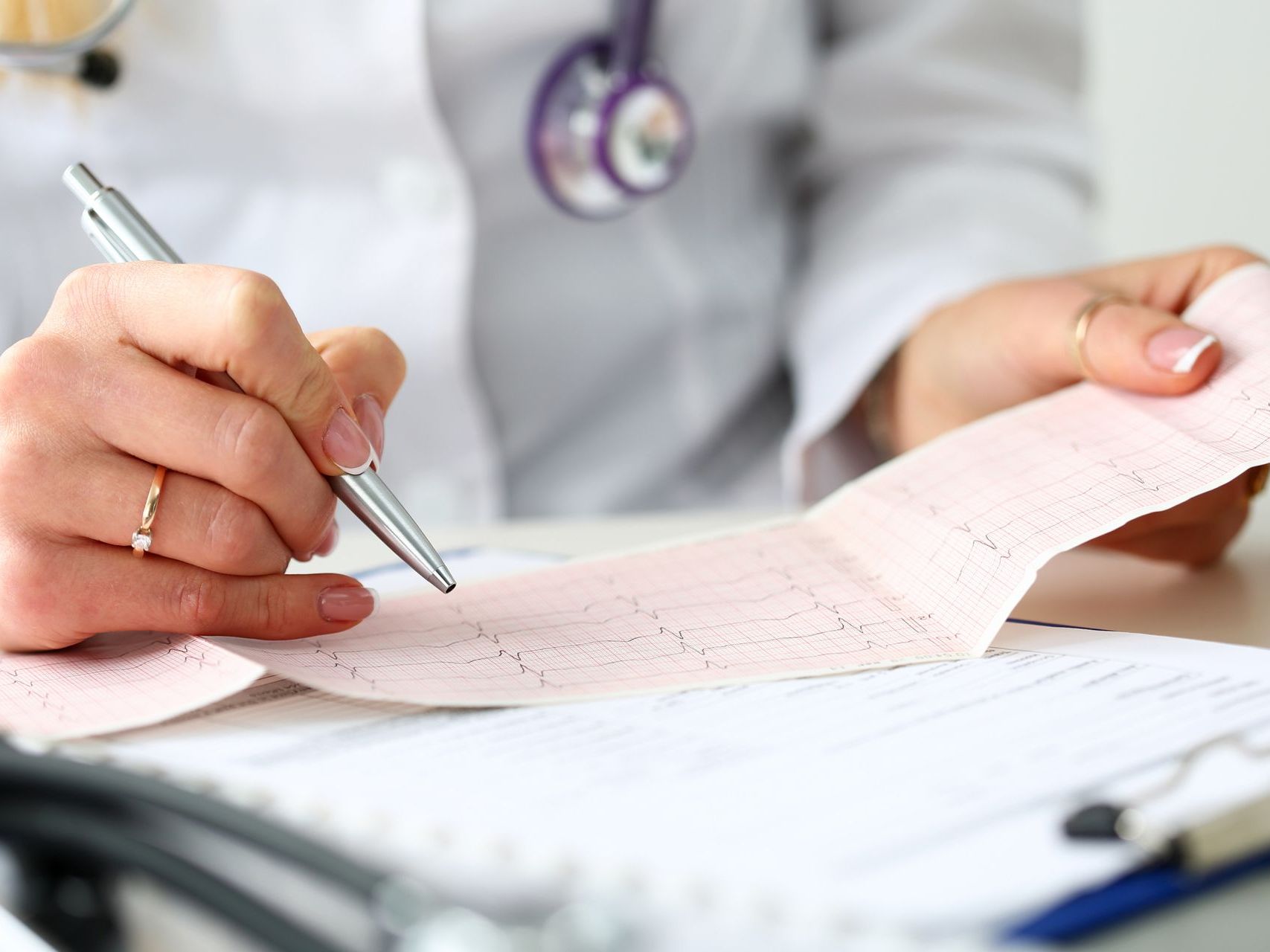 Consulta cardiológica habitual