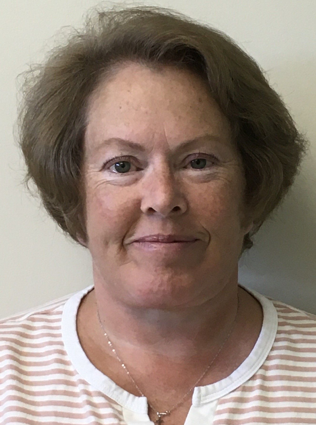 Facelift with Chin Implant after