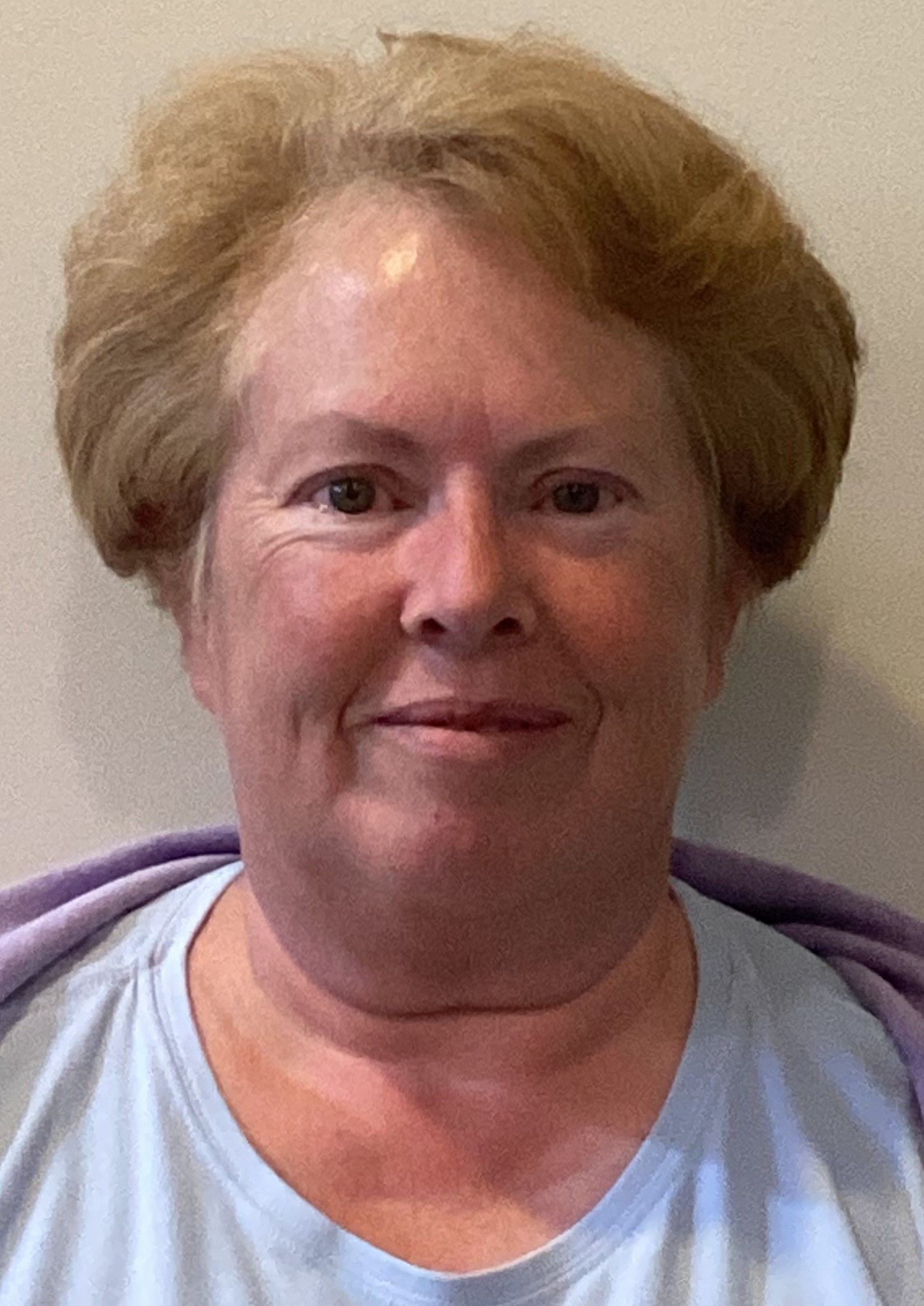Facelift with Chin Implant before