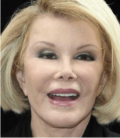 The over inflated cheeks and squinty eyes, typical of a dangerous “cosmetic” focus – if you see this in a “Cosmetic Injector” . . . RUN!