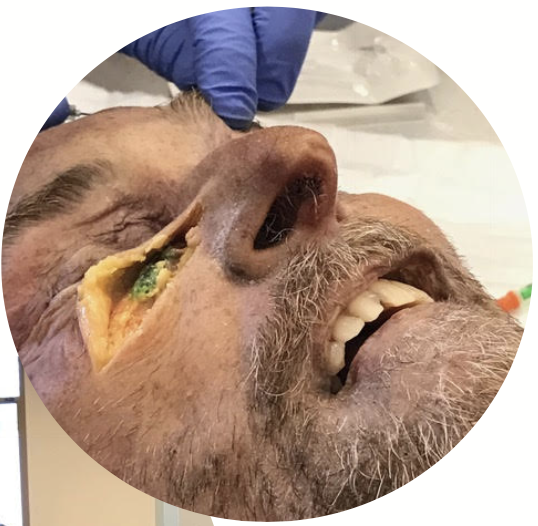 A man with a beard is being examined by a doctor
