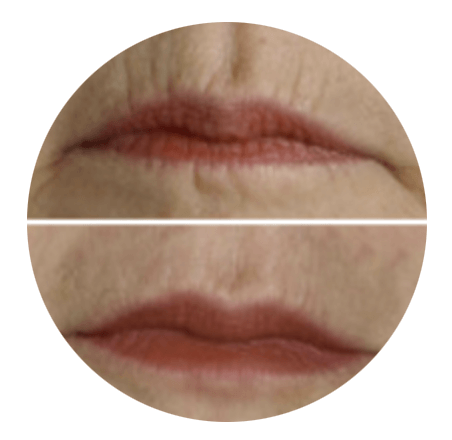A before and after photo of a woman 's mouth