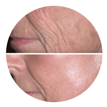 A before and after photo of a woman 's face