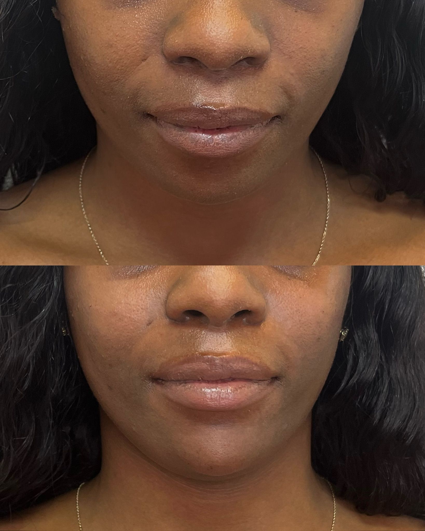 Two close-up face photos before and after.