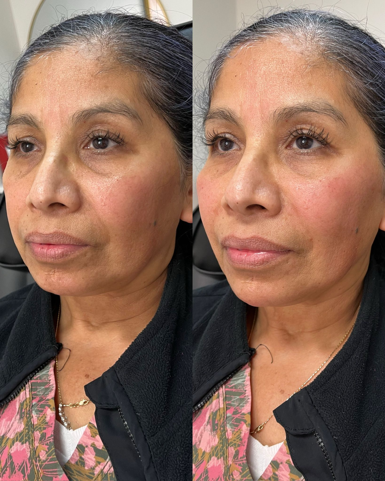 Before and after portraits of the same person.