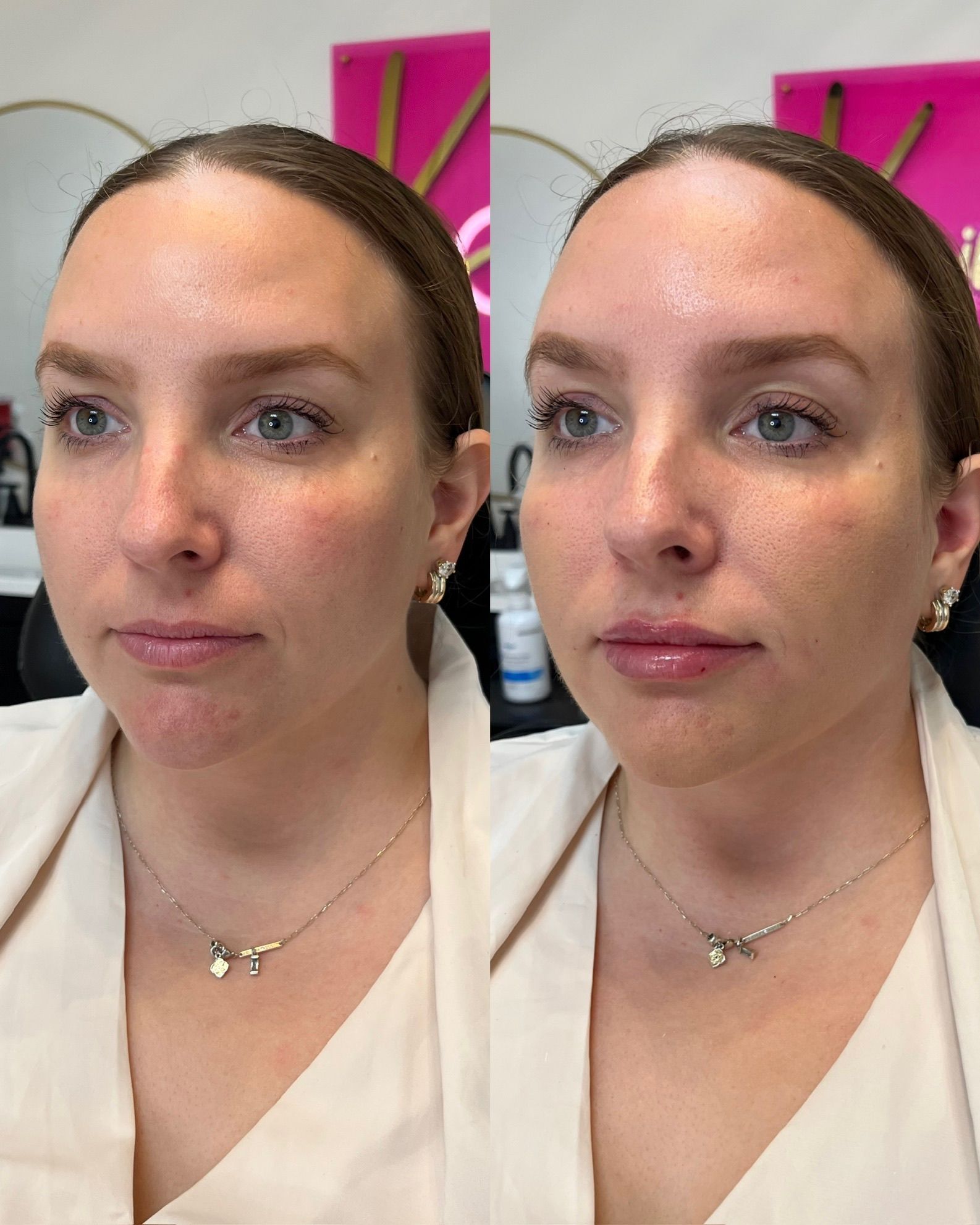 Side-by-side portrait of a woman in a white blouse, before and after, against a pink background
