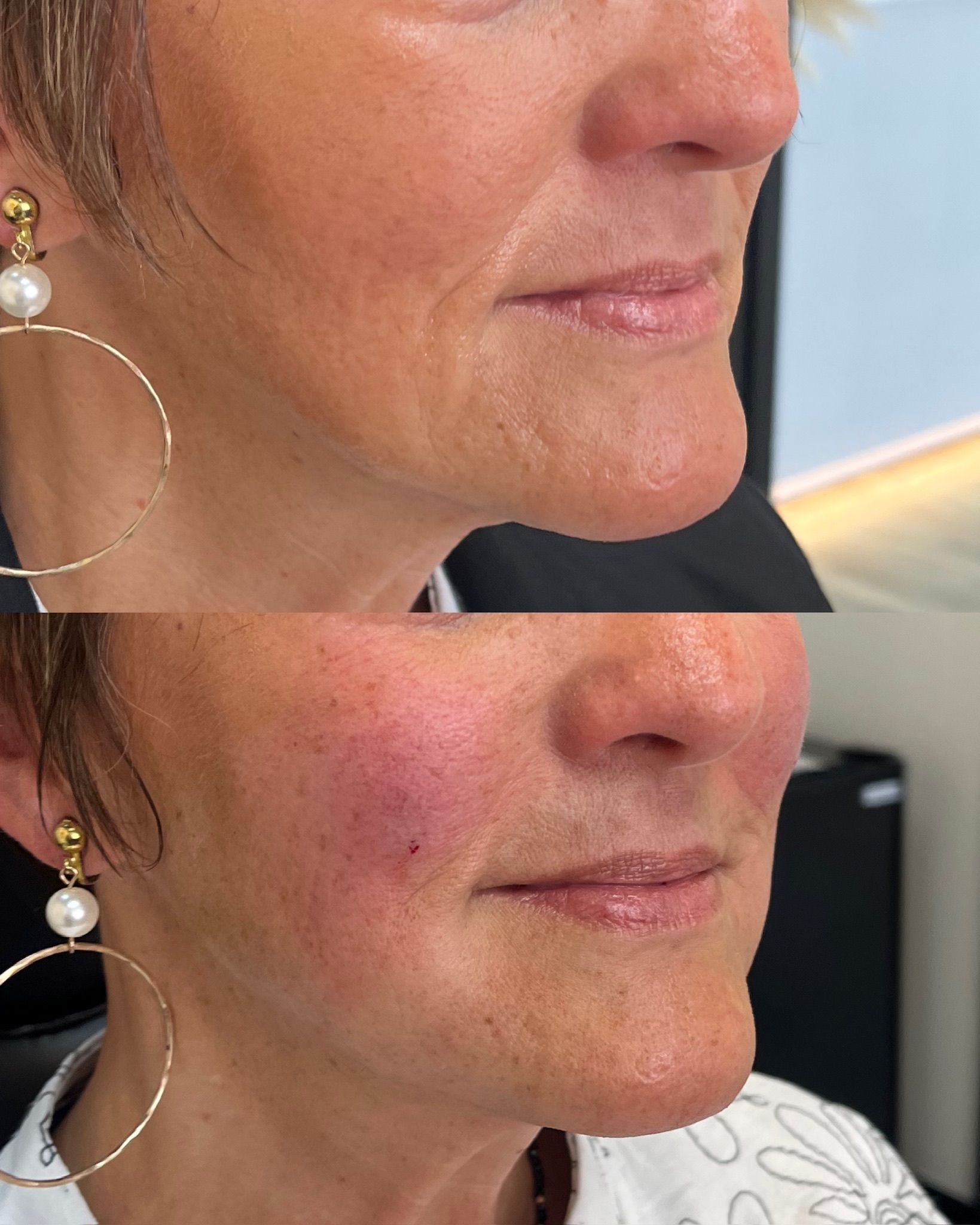 Before-and-after side profile.