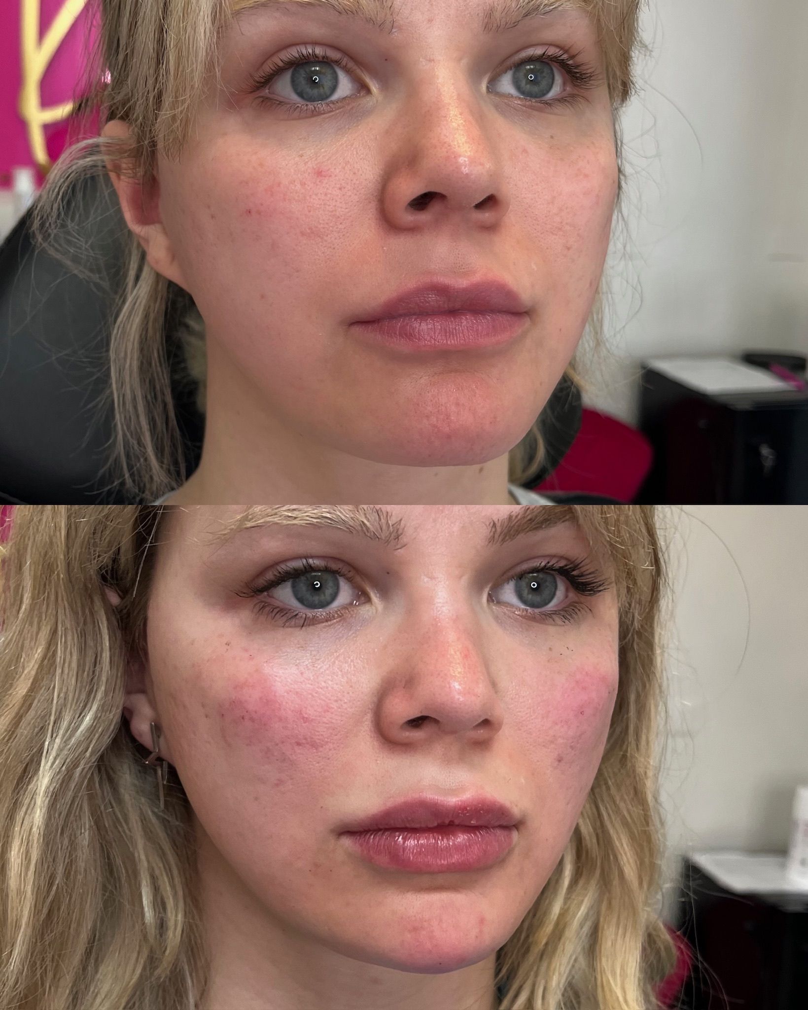 Two close-up before and after photos.