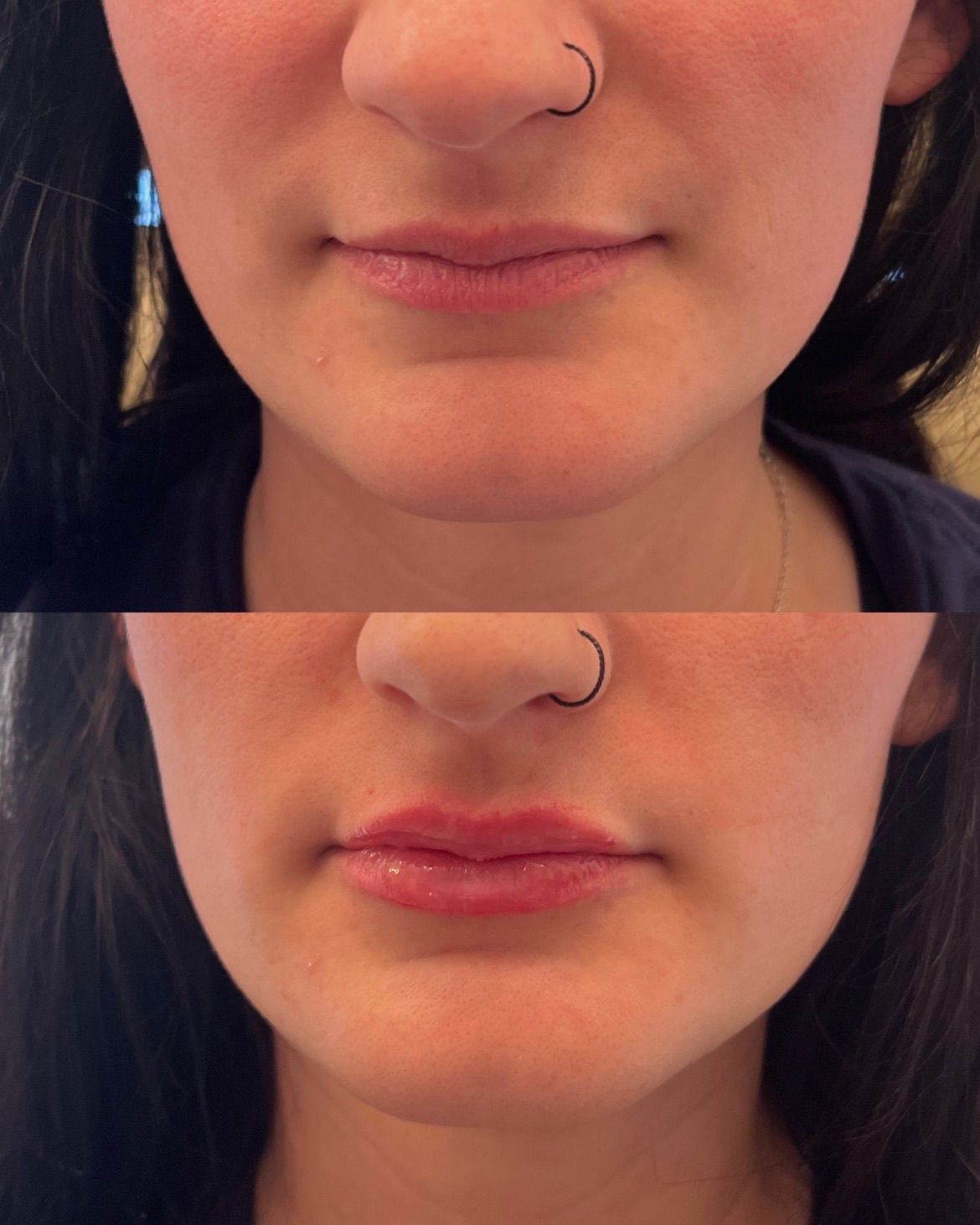 Before and After photos.