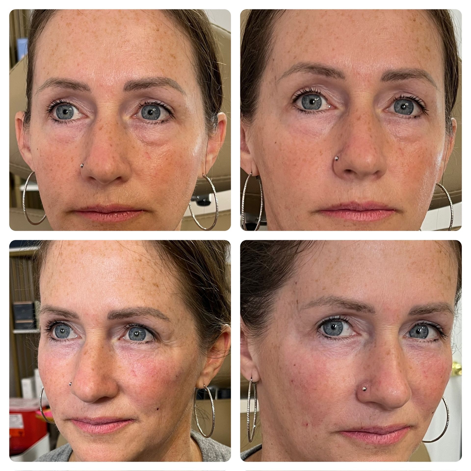 Four side-by-side close-up portraits of the same woman, showing before and after.