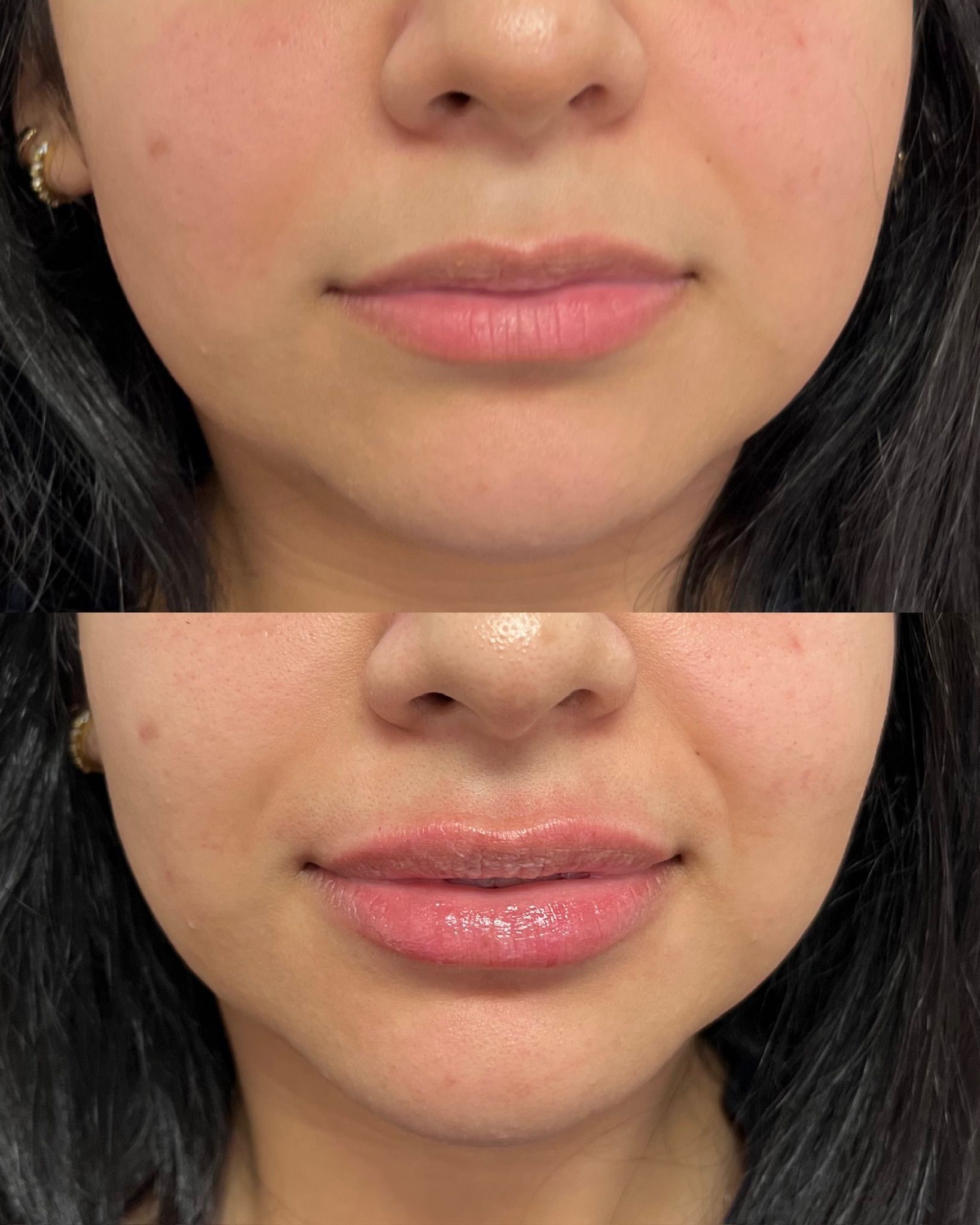 Close-up of lips before and after.