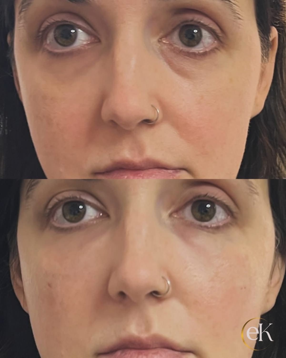 Split-face close-up of a woman, before and after, with a nose ring, showing a subtle difference in the eyes and cheeks.