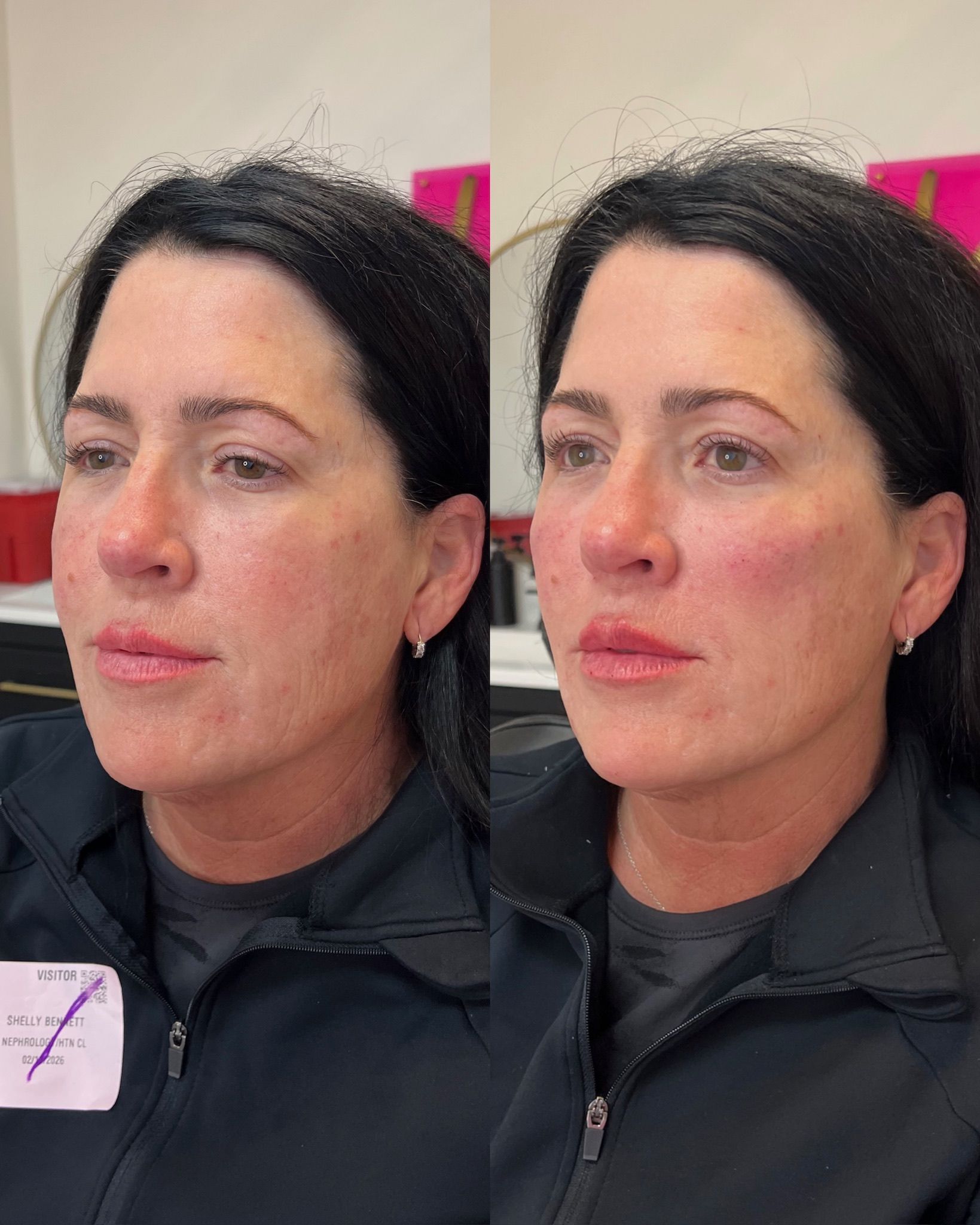 Side-by-side portrait of a woman, before and after.
