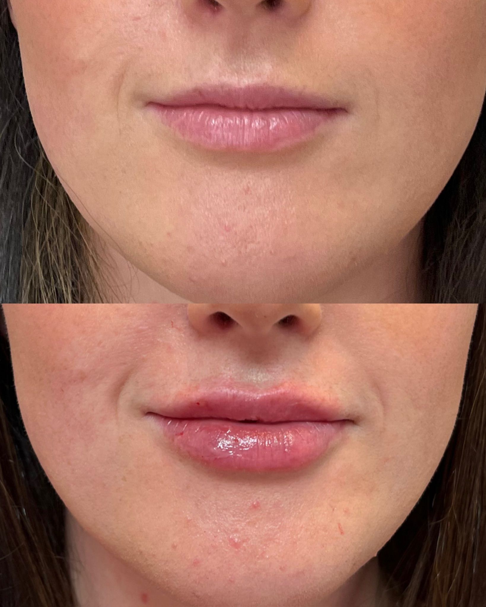 Split close-up of lips: before and after.