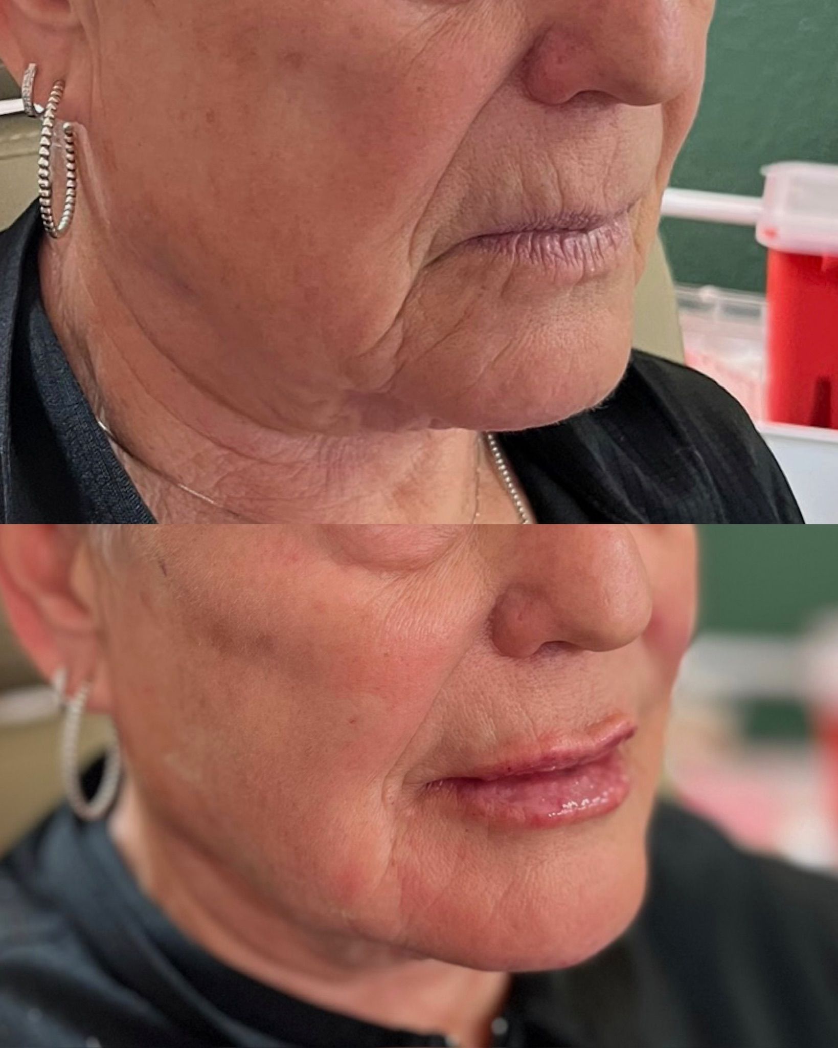 Close-up of a person’s face in profile.
