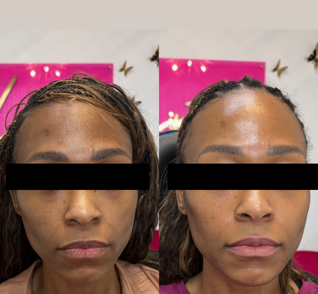 Side-by-side close-up selfies showing a woman before and after services, with pink background.