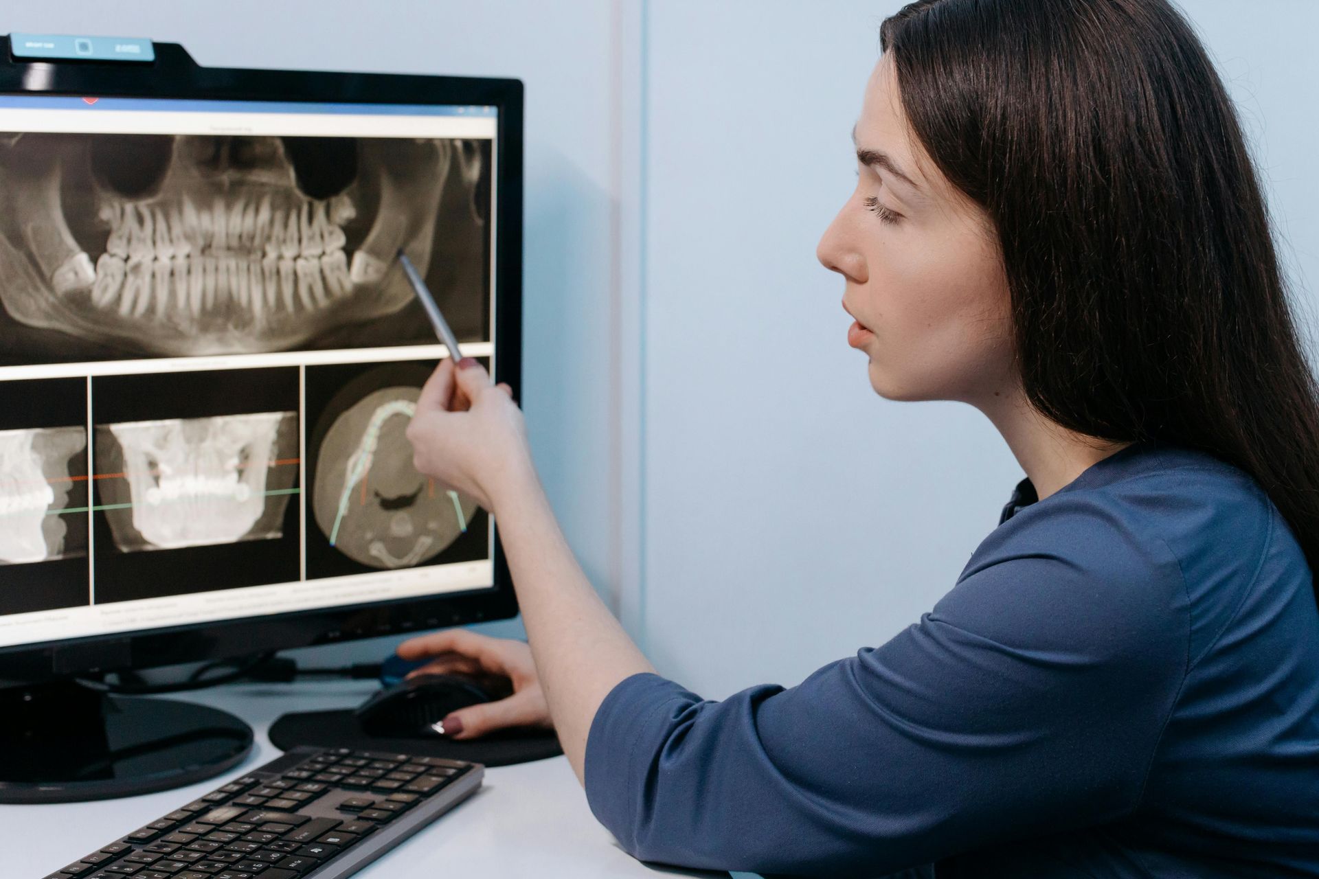 A woman is looking at an x-ray on a computer screen.