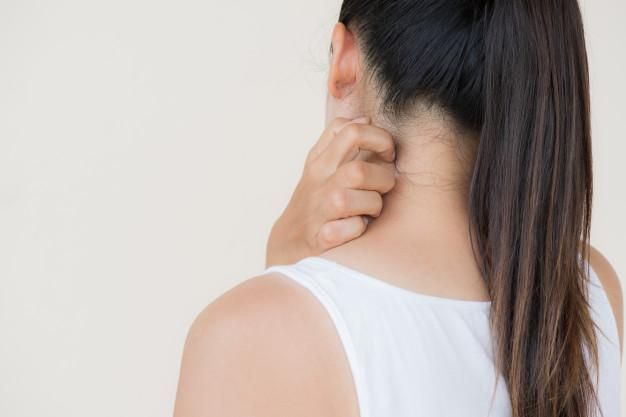 woman with eczema on neck