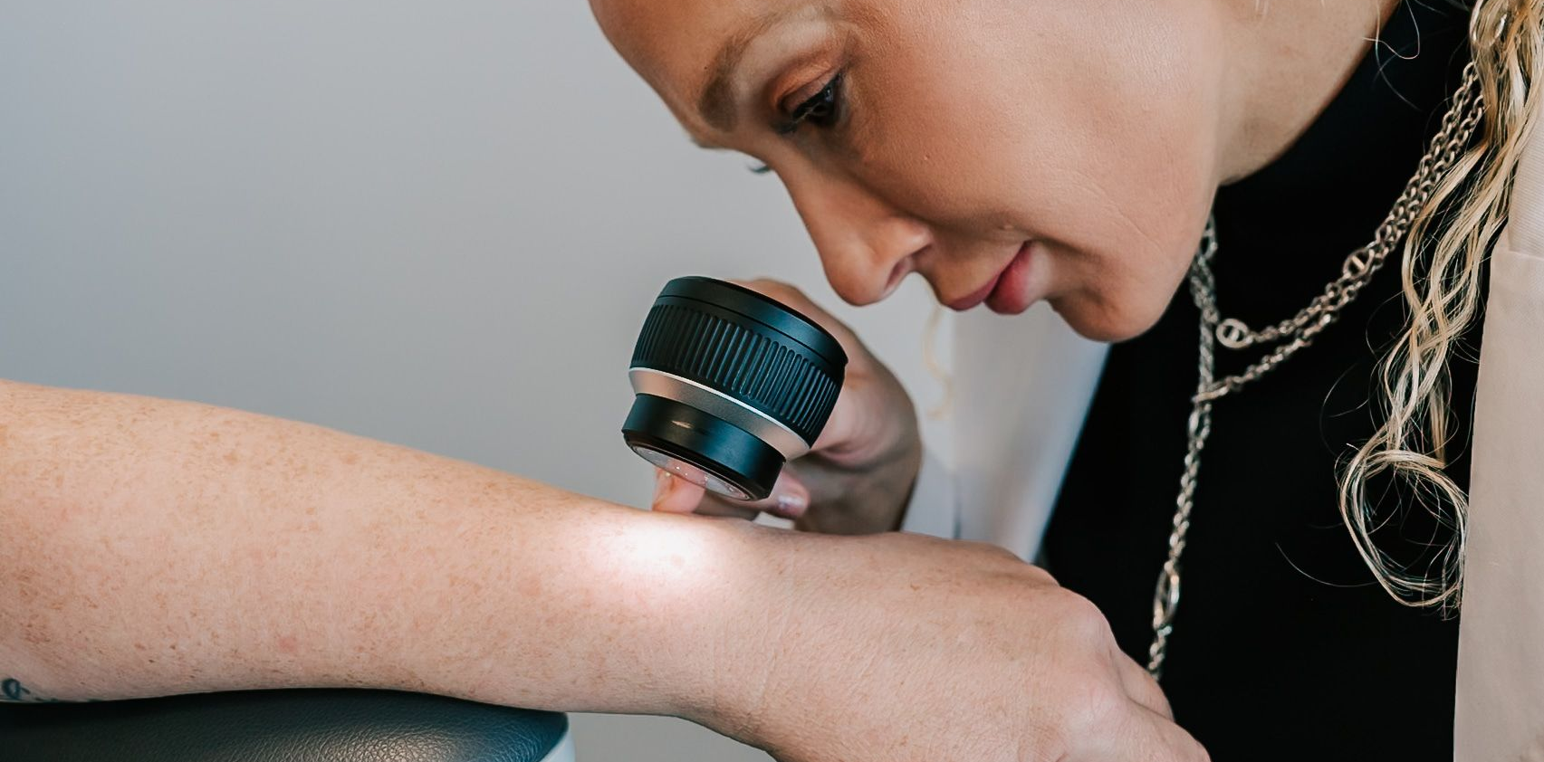 dermatoscope