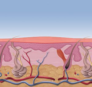 Step-by-step treatment of swift wart removal