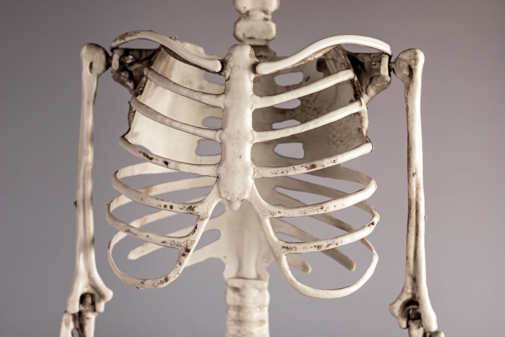 Esqueleto do torso, mostrando costelas, coluna vertebral e ossos do braço, contra um fundo cinza.