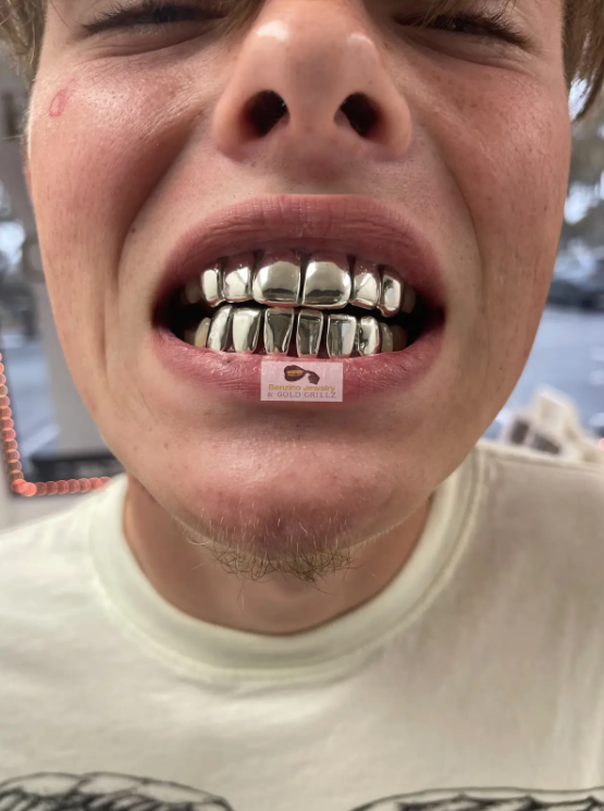 grill teeth