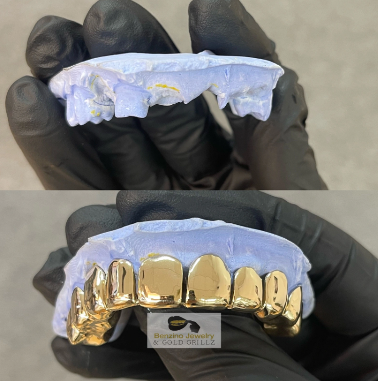 gold teeth caps