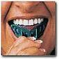 gold grillz