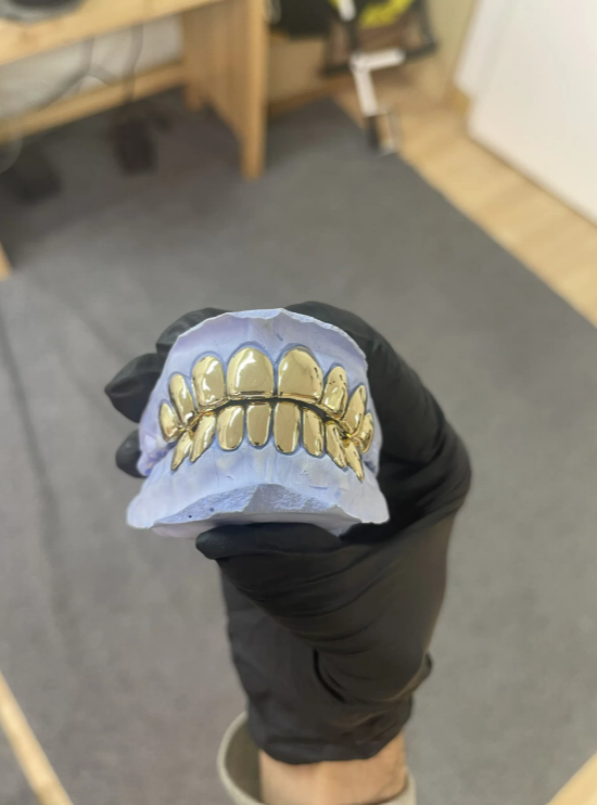 gold grillz teeth