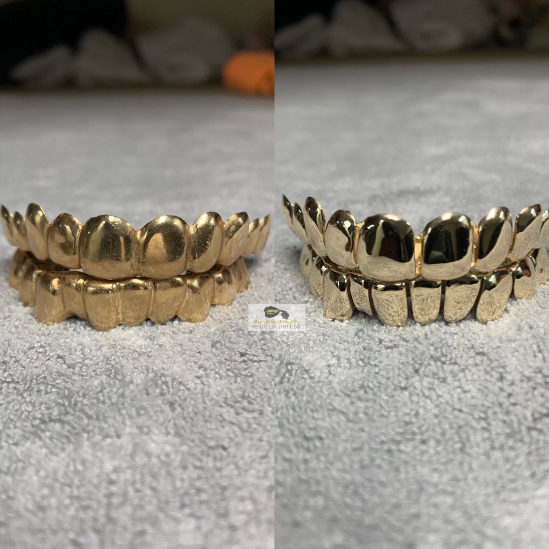 grill for teeth