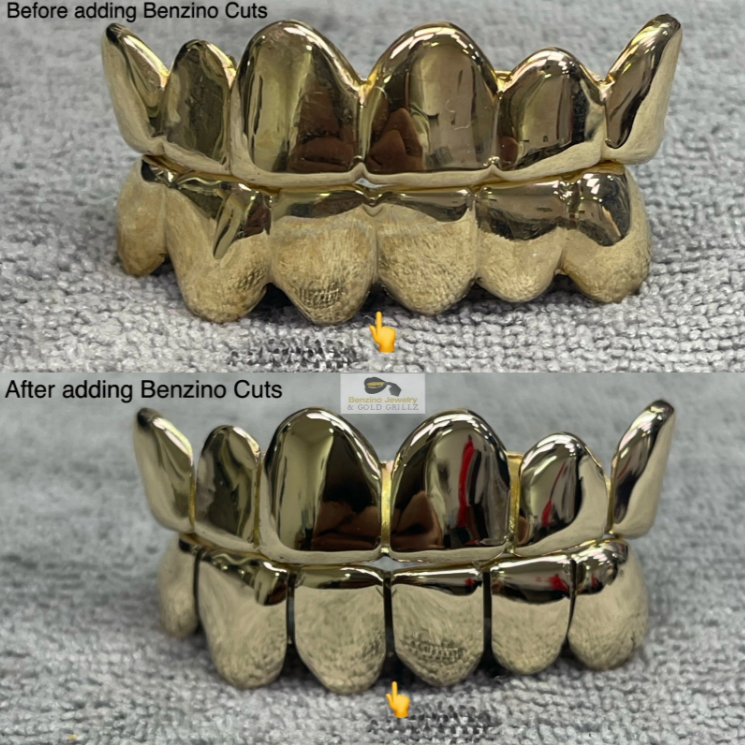 gold grillz teeth