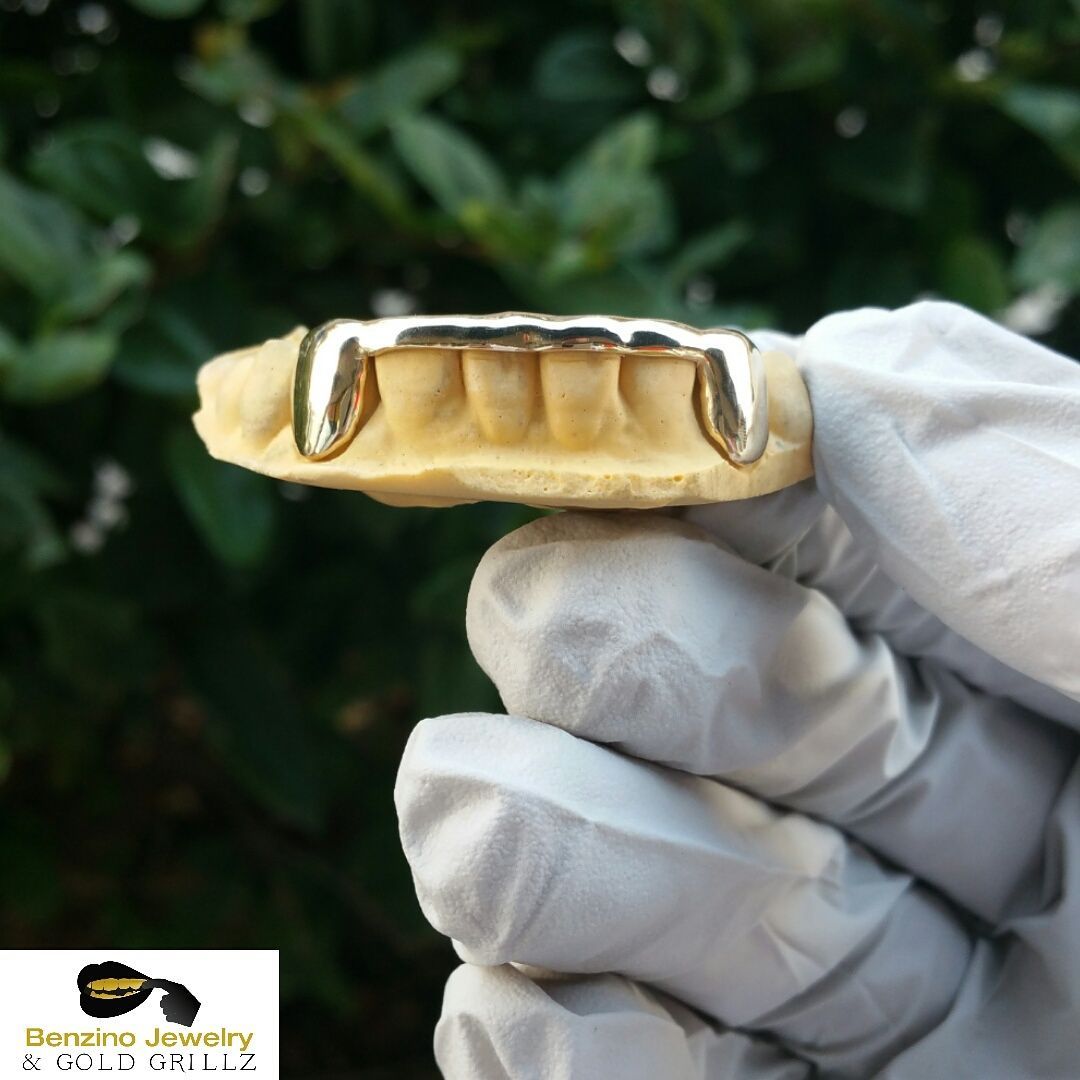 permanent gold teeth