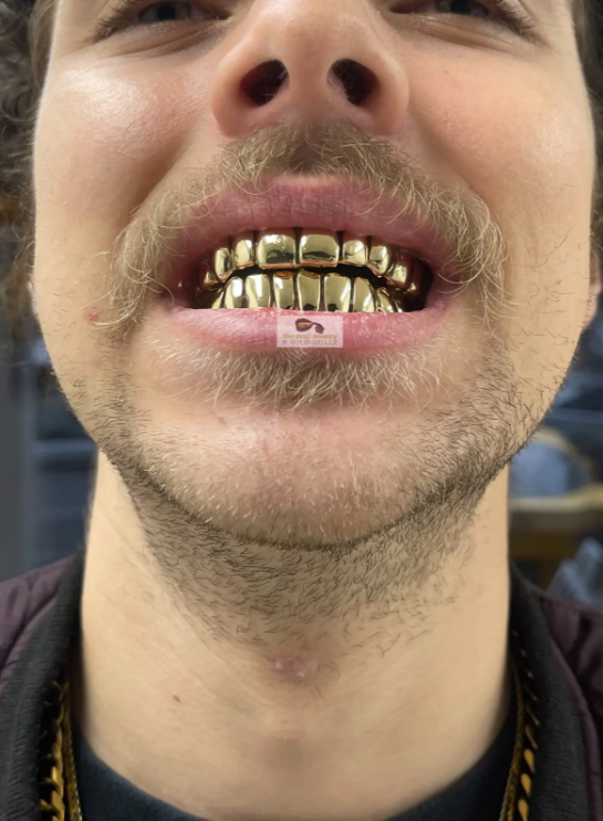 gold frown