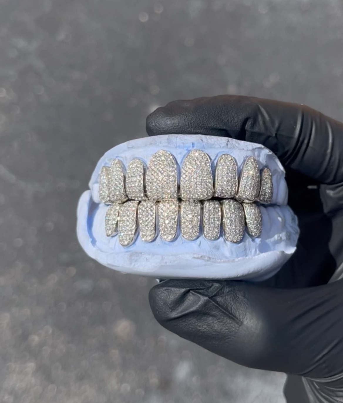 custom gold grillz