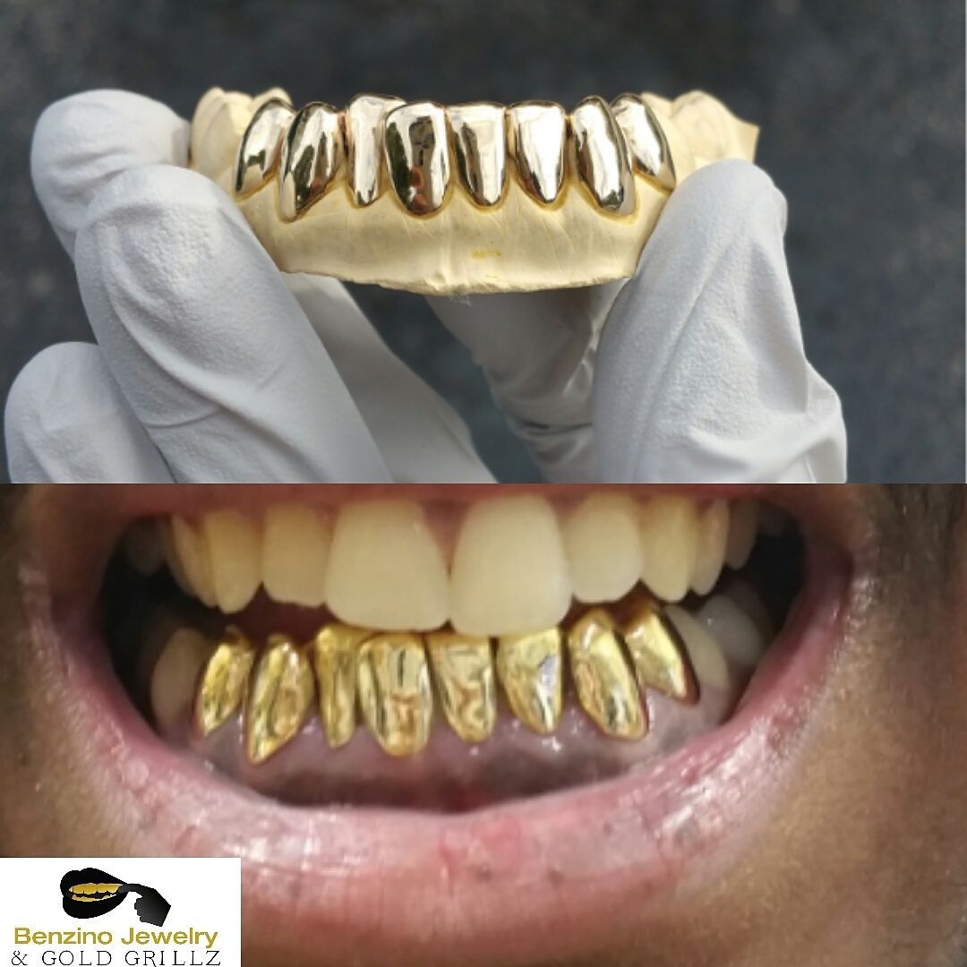 gold grills