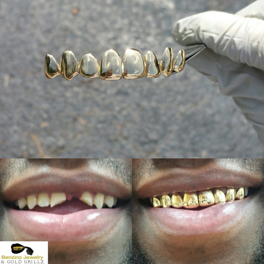 gold frown