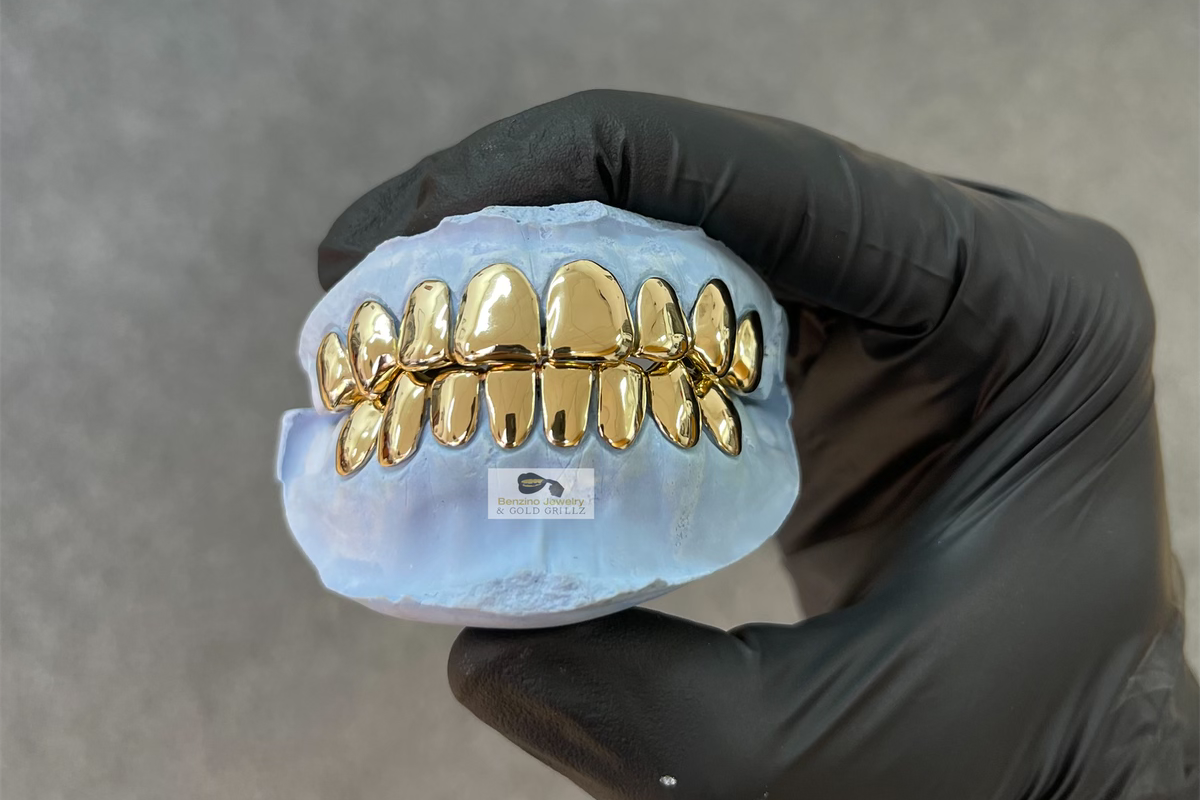 gold grills in florida