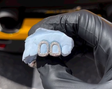 diamond grillz florida