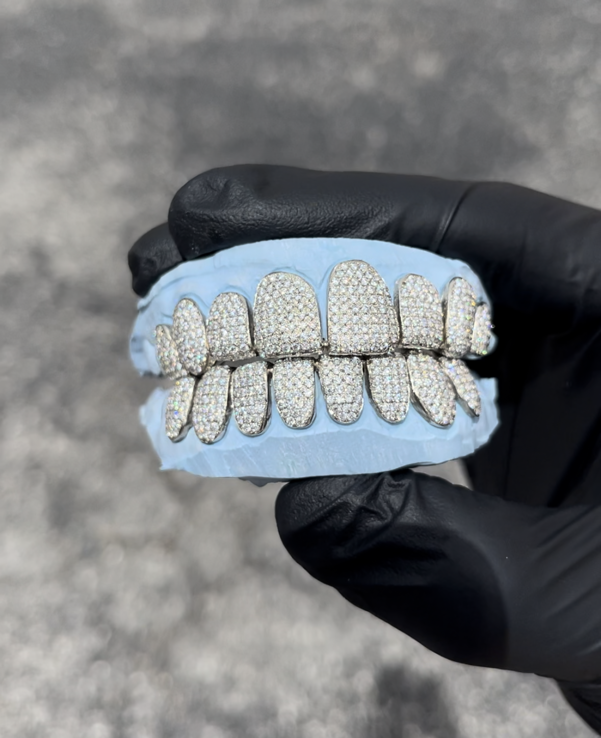 shop-custom-grillz-benzino-jewelry-gold-grillz