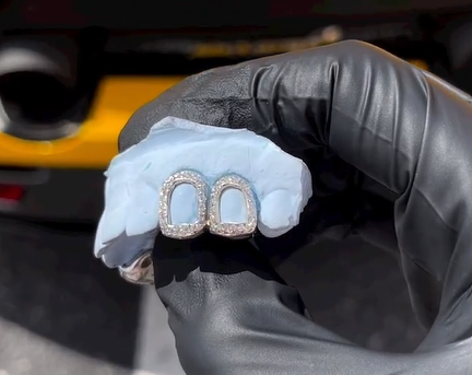 Permanent Gold Grillz vs Pull Out Gold Grillz | Benzino Jewelry