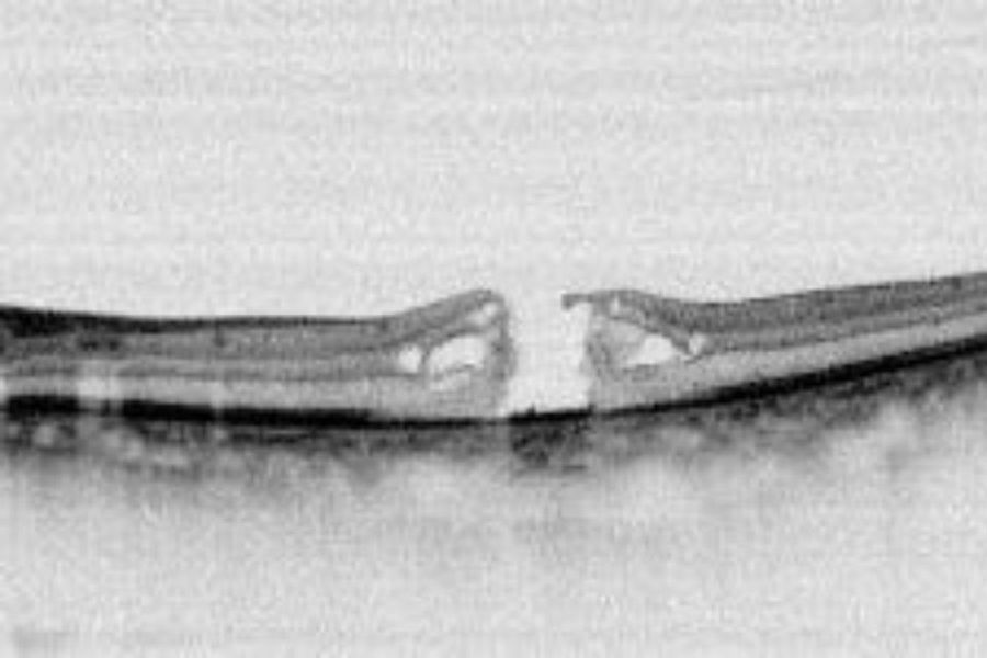 test diagnostico di tomografia