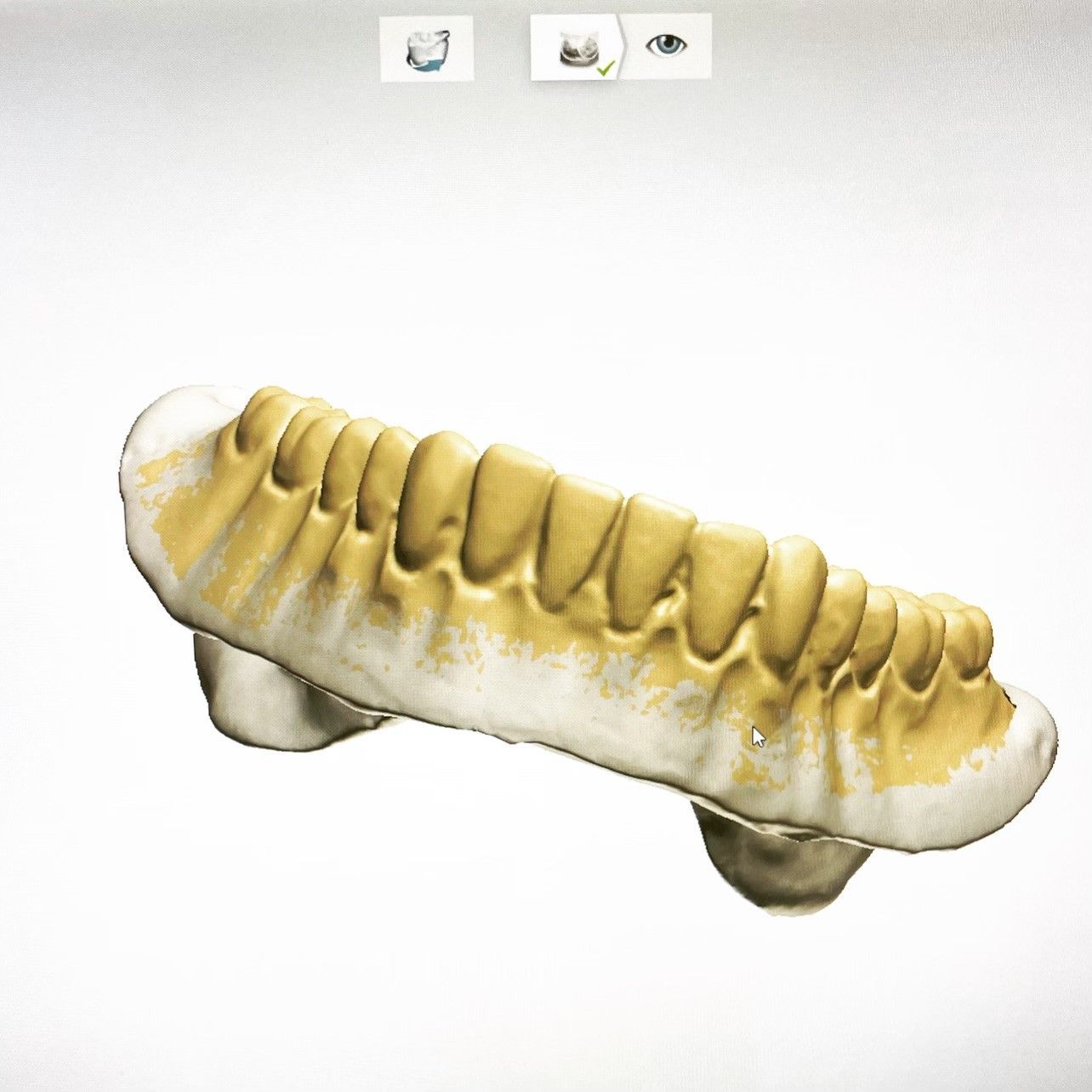 A computer generated image of a set of teeth