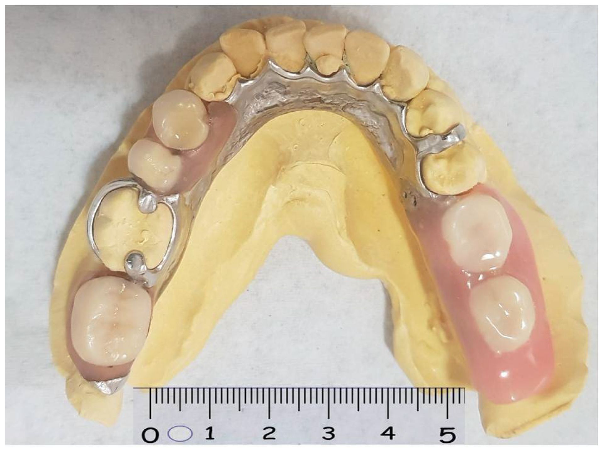 A model of teeth with a ruler showing the numbers 1 through 5