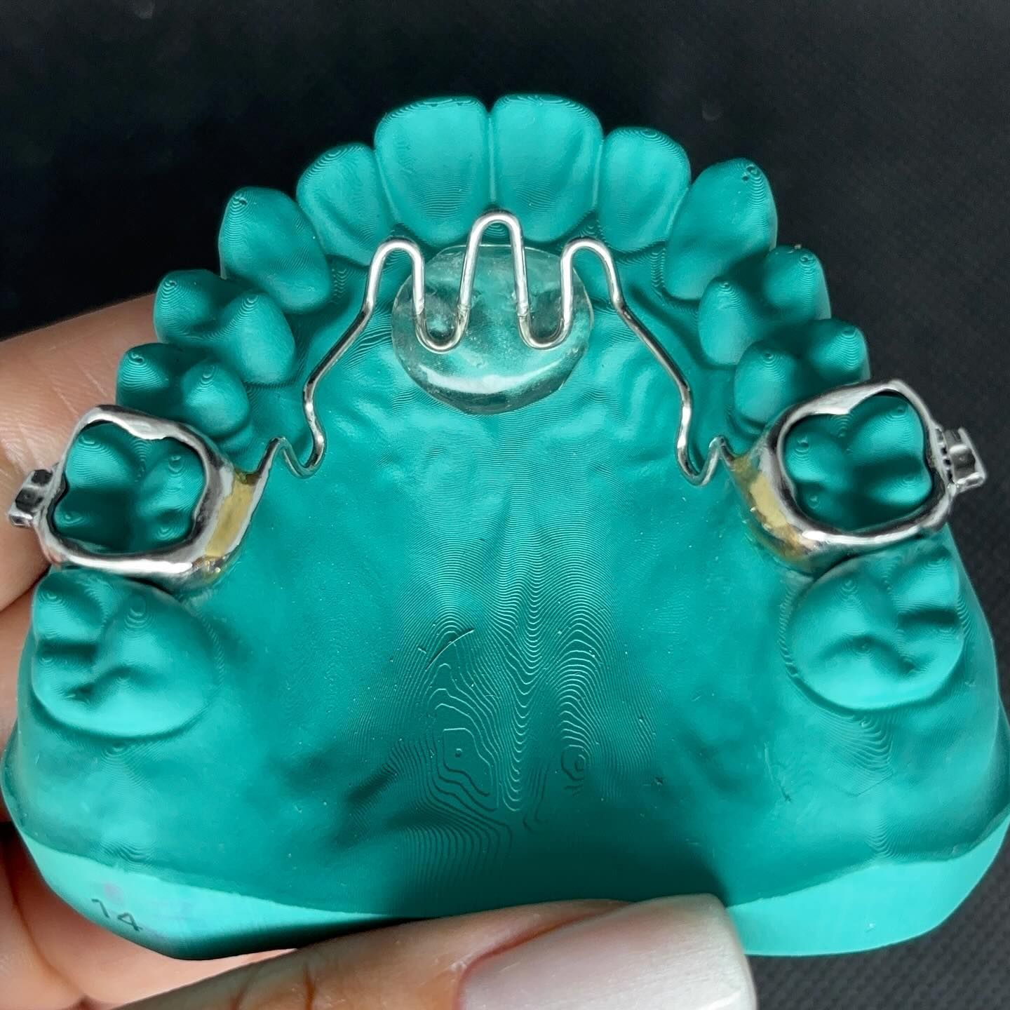 A person is holding a model of teeth with braces on it